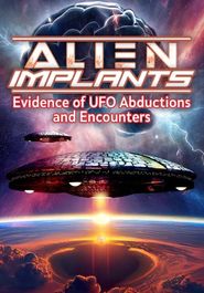 Alien Implants: Evidence of UFO Abductions and Encounters Poster