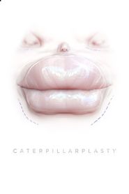  Caterpillarplasty Poster
