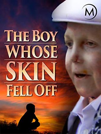  The Boy Whose Skin Fell Off Poster