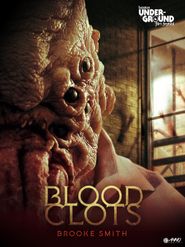  Blood Clots Poster