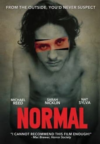  Normal Poster