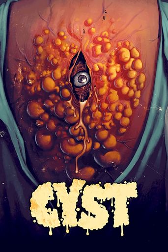  Cyst Poster