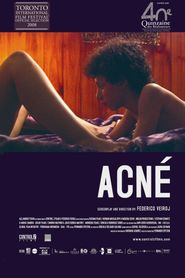  Acne Poster