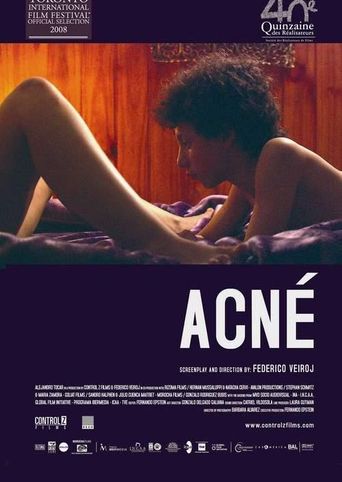 Acne Poster
