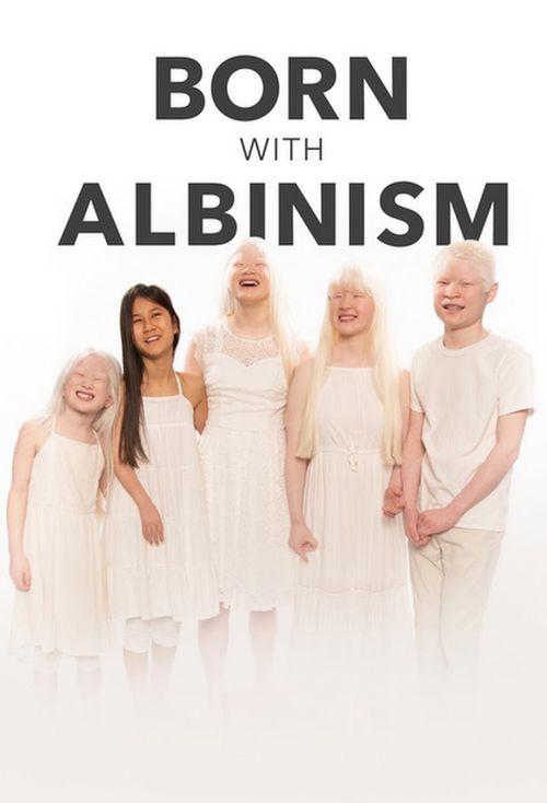 Born with Albinism Poster