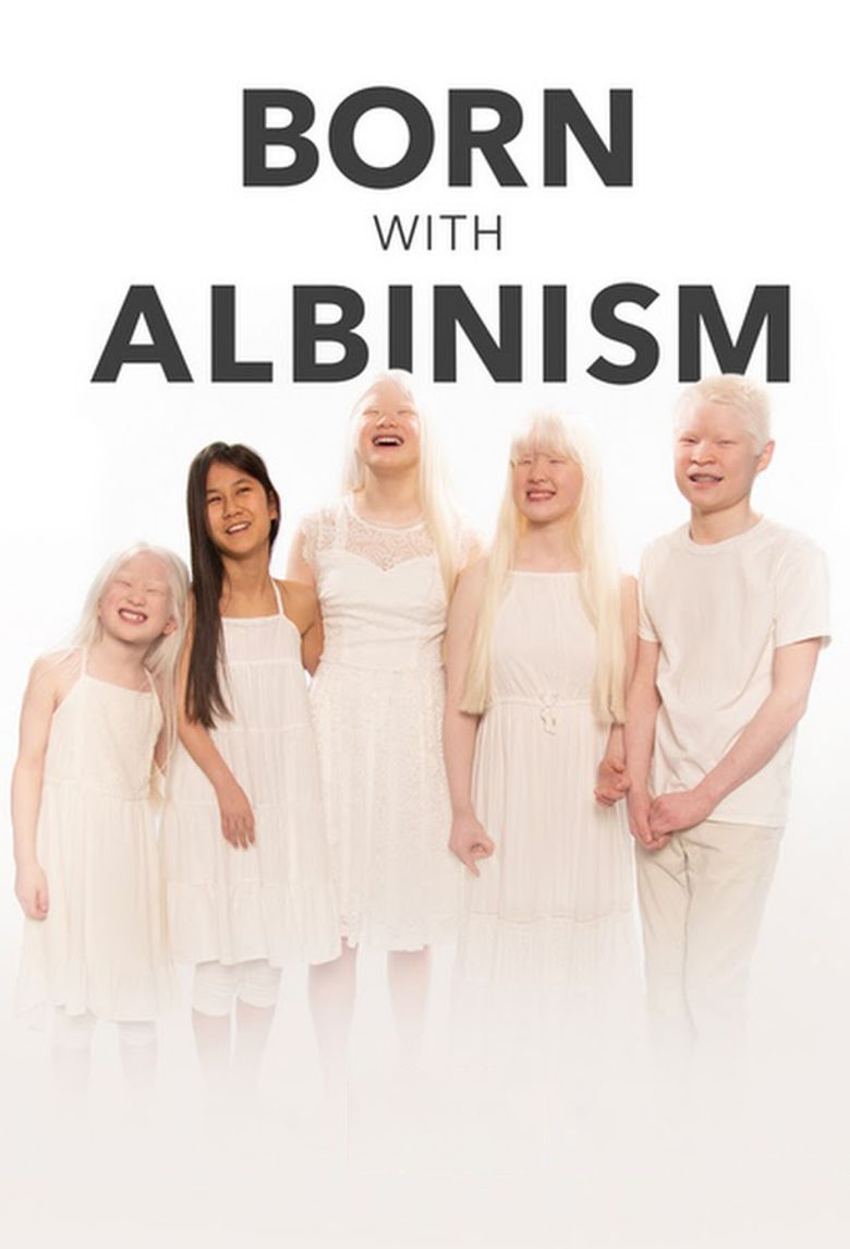 Born with Albinism Poster