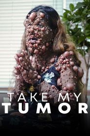  Take My Tumor Poster